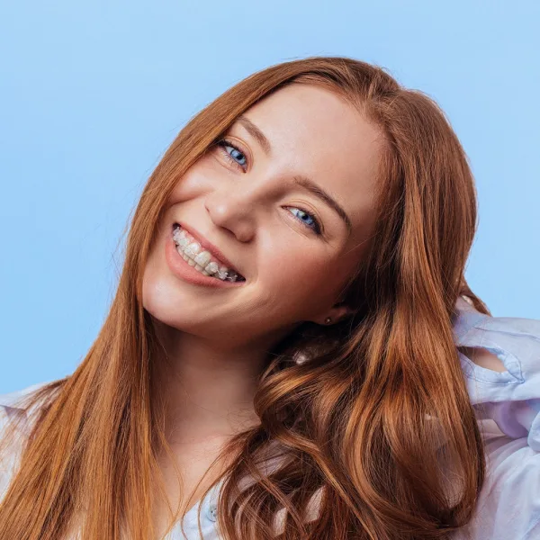 Smile White